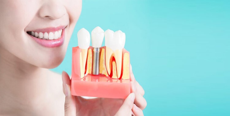 Hawkesbury Dentist Implant Dental Services